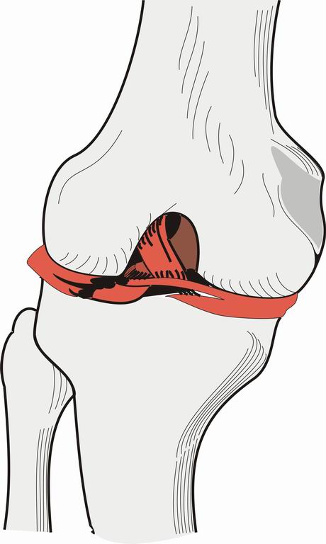 ../Images/KNEECART.jpg